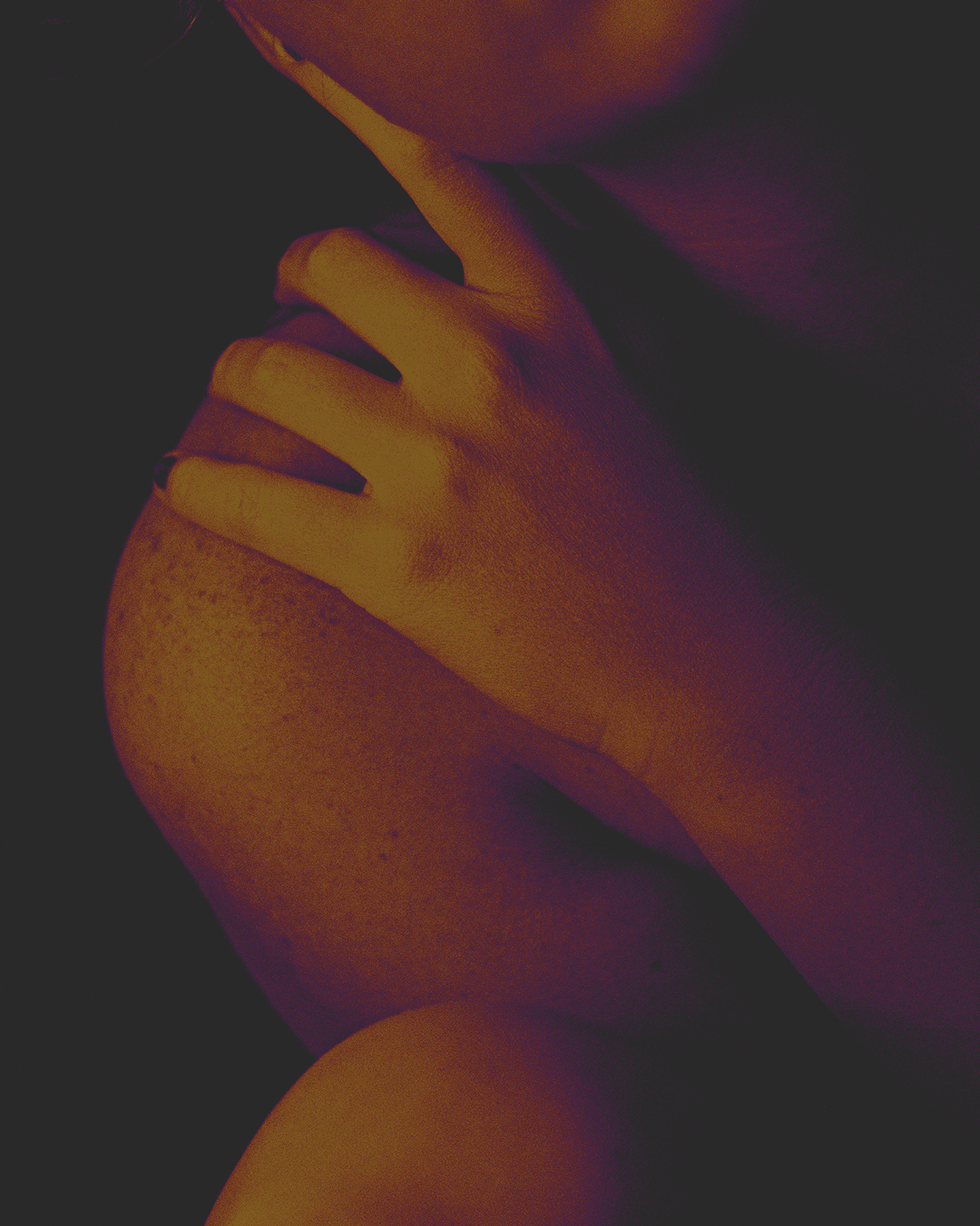 POSTER AFTER SKIN